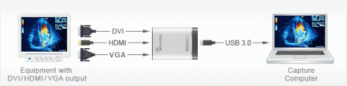 Diagram showing the connection of the external acquisition device DVI2USB 3.0™ by Epiphan Systems Inc. Credits: epiphan.com.